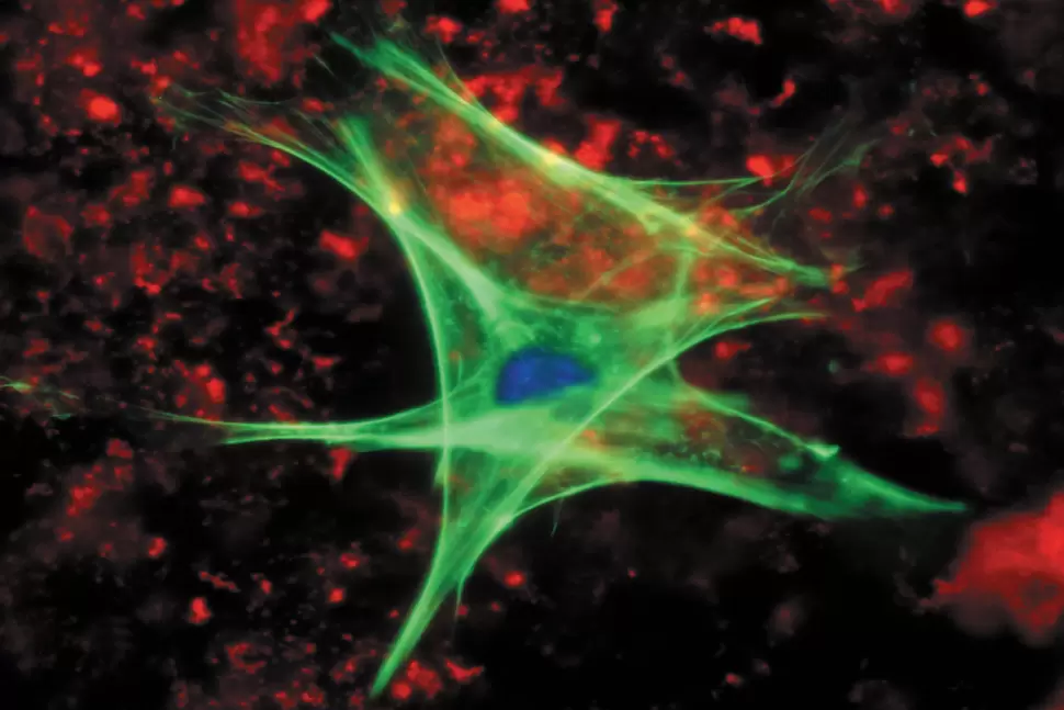 Figure 1: Fluorescence microscopy image of a cell