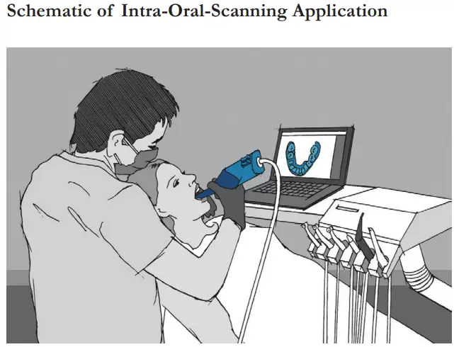 Schematic of Intra-Oral-Scanning Application