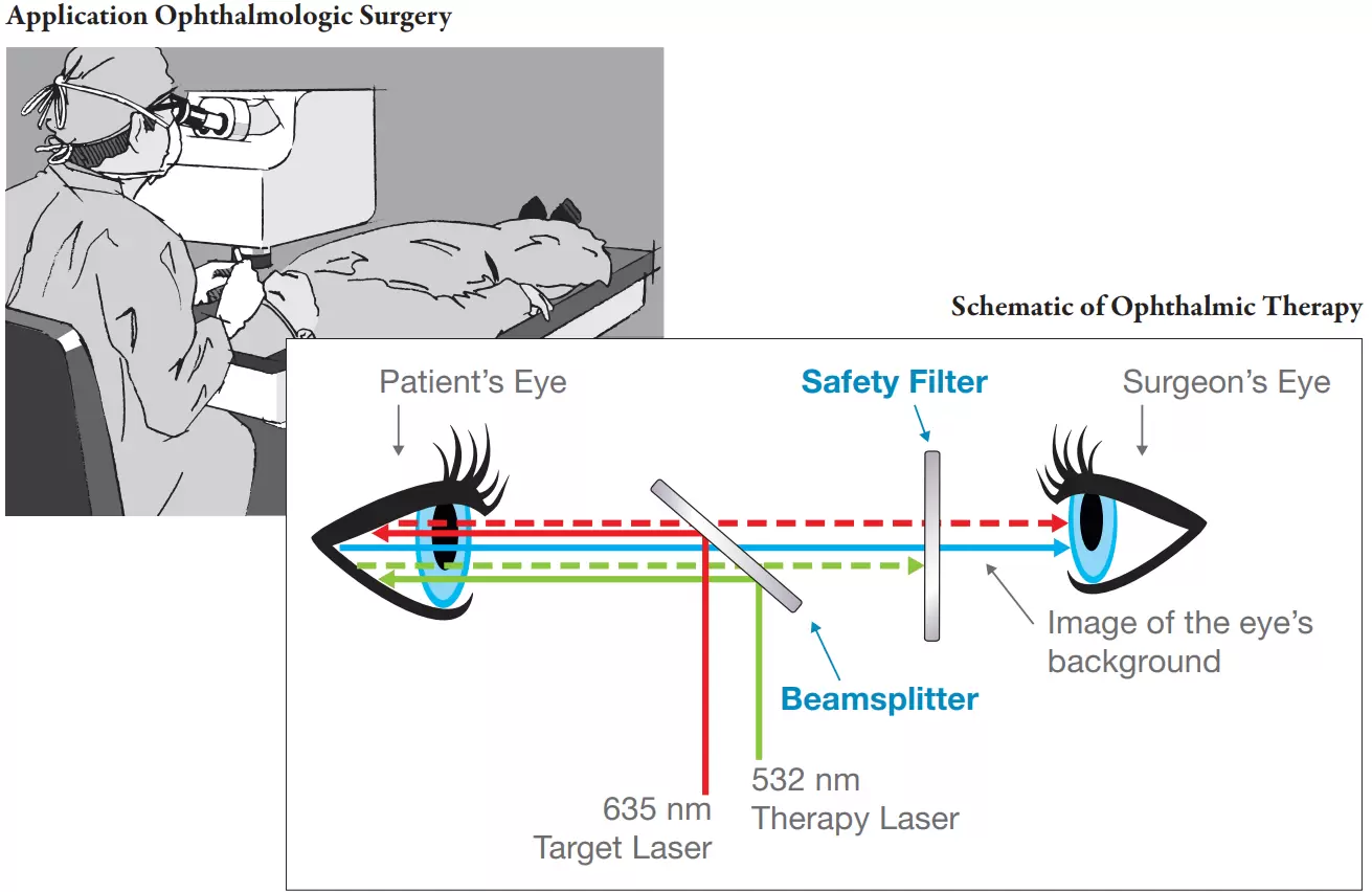 Application Ophthalmologic Surgery & Schematic of Ophthalmic Therapy
