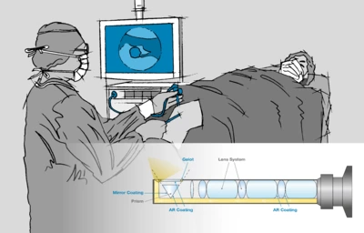 Endoscopic applications