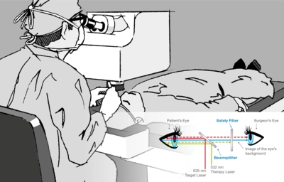 Laser Blocking Filters